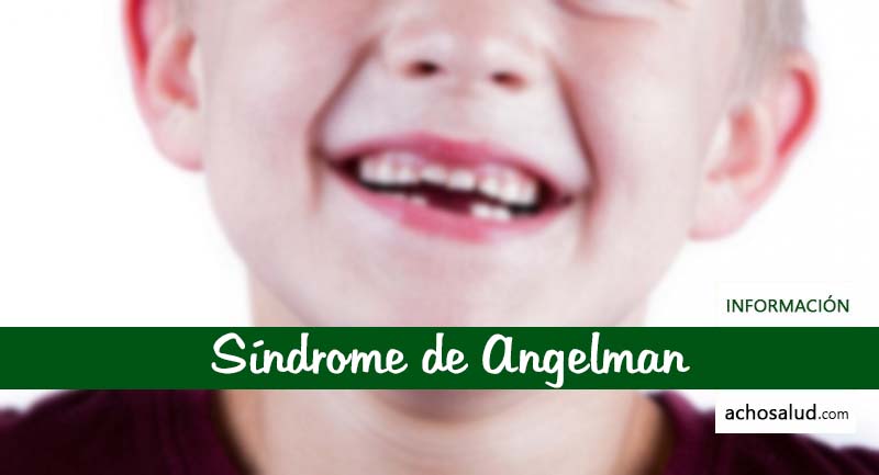 Síndrome de Angelman