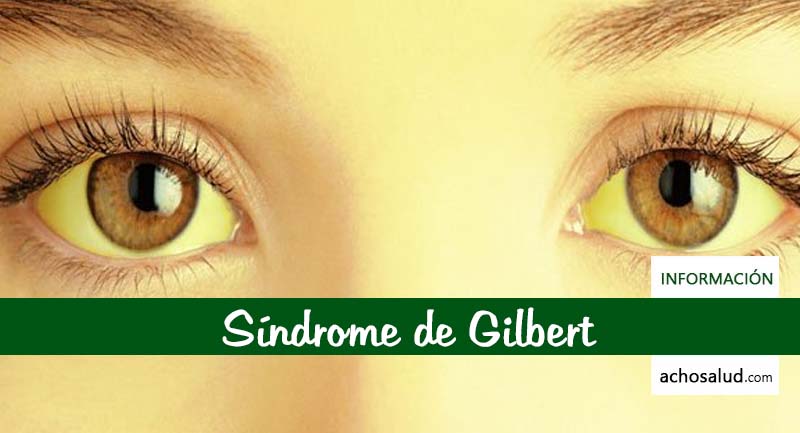 Sindrome de gilbert sintomas