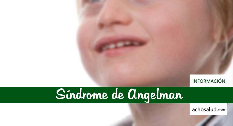 Síndrome de Angelman Fotos