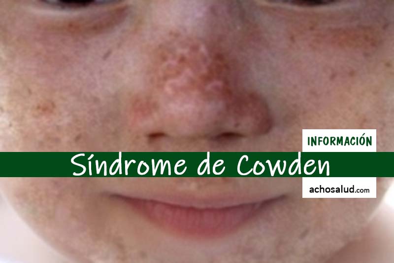 Síndrome de Cowden