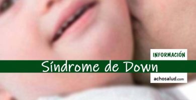 Síndrome de Down