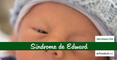 Síndrome de Edward