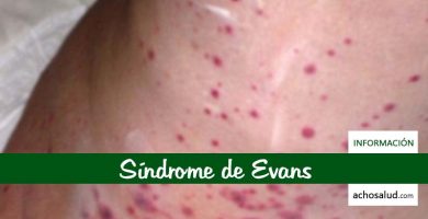 Síndrome de Evans