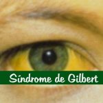 Síndrome de Gilbert