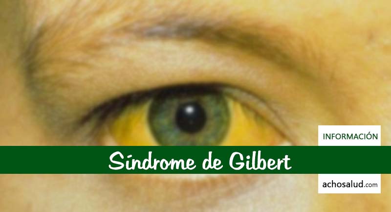 Síndrome de Gilbert