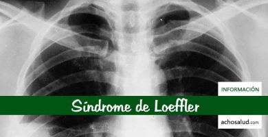 Síndrome de Loeffler