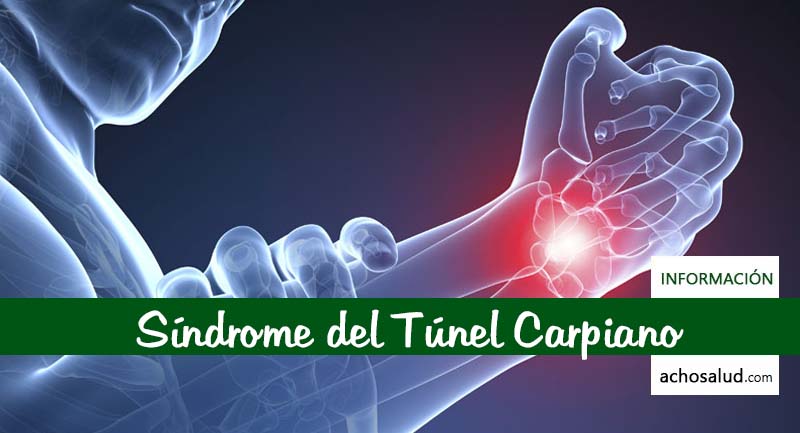 Sindrome Tunel Carpiano operacion