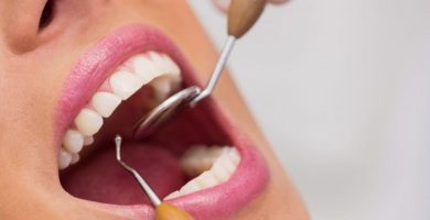 Como eliminar el sarro de los dientes